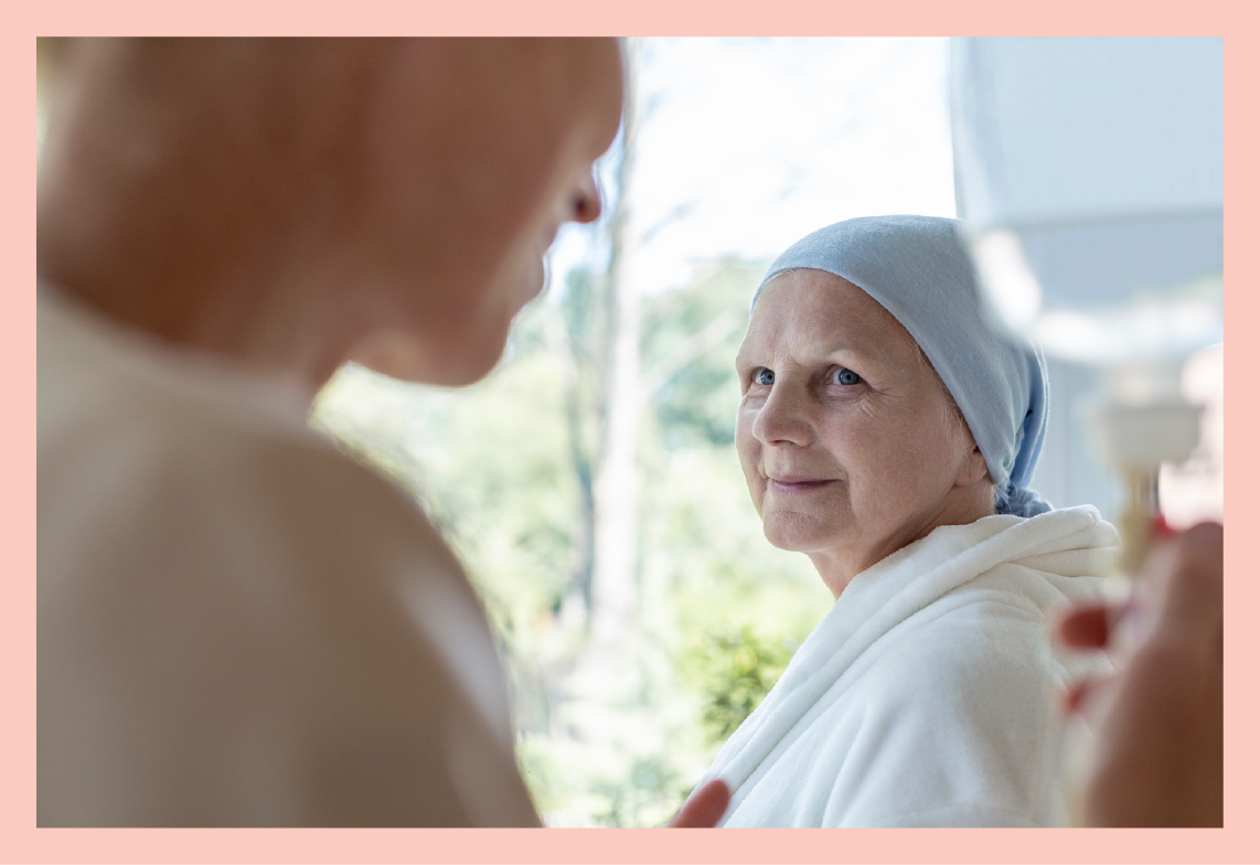 Patiënt met lymfeklierkanker die zijn haar heeft verloren na een chemotherapiebehandeling